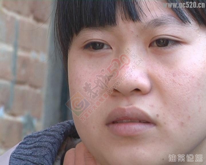 为因病失学少女李雨琼募捐倡仪书662 / 作者:恭城蚂蜂 / 帖子ID:106134