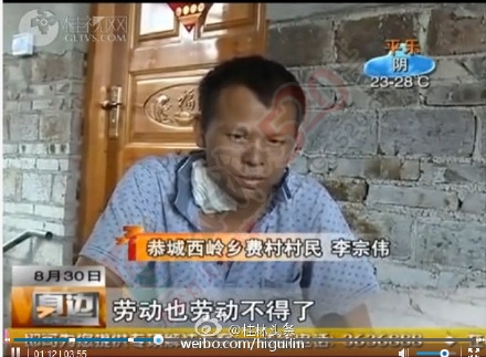 【爱心援助】恭城｜哥欲捐肾救弟梦难圆261 / 作者:猫小萌 / 帖子ID:120798