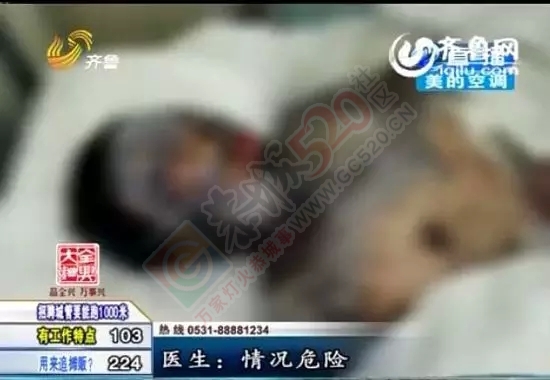 【惨不忍睹】女子遭浓酸泼脸毁容，上半身严重烧伤奄奄一息33 / 作者:额外听歌 / 帖子ID:121249