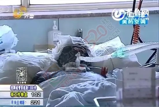 【惨不忍睹】女子遭浓酸泼脸毁容，上半身严重烧伤奄奄一息902 / 作者:额外听歌 / 帖子ID:121249