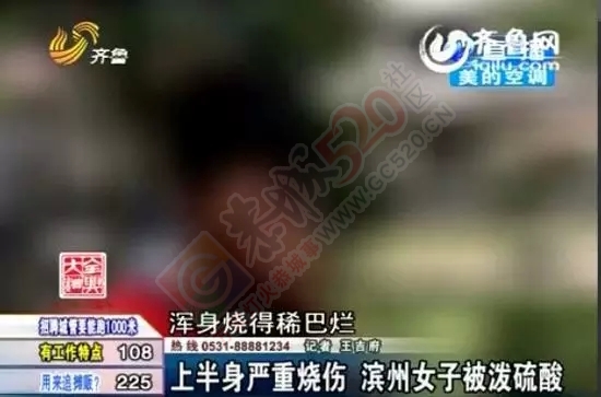 【惨不忍睹】女子遭浓酸泼脸毁容，上半身严重烧伤奄奄一息358 / 作者:额外听歌 / 帖子ID:121249
