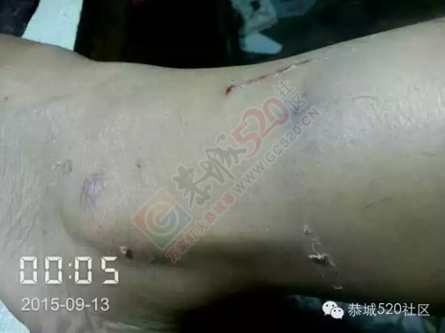 微友：秧家村委&quot;最牛&quot;村主任纵使其儿子动手打人975 / 作者:社区小编 / 帖子ID:121492