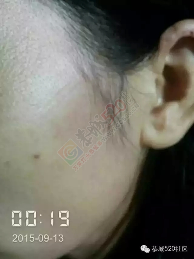 微友：秧家村委&quot;最牛&quot;村主任纵使其儿子动手打人548 / 作者:社区小编 / 帖子ID:121492