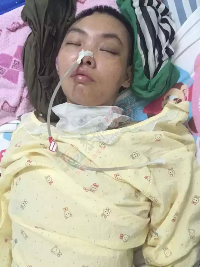 【爱心救助】无良司机肇事逃逸，恭城女子重伤治疗陷入困境270 / 作者:社区小编 / 帖子ID:127702