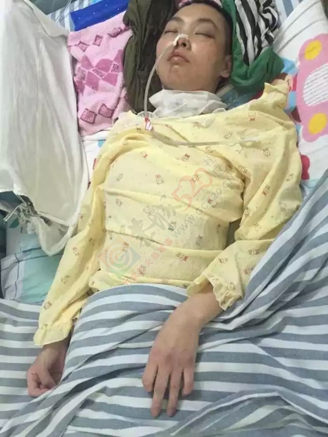 【爱心救助】无良司机肇事逃逸，恭城女子重伤治疗陷入困境811 / 作者:社区小编 / 帖子ID:127702