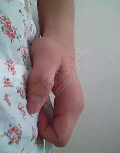拍肚子，原来好处这么多！910 / 作者:该做的事情 / 帖子ID:128198