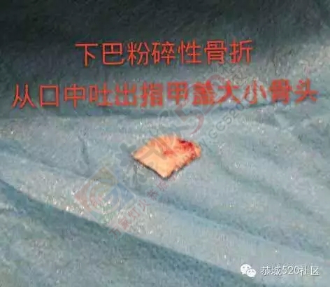 栗木一女子四楼失足高空坠落重伤，请大家都来帮帮这两岁孩子的母亲165 / 作者:520小编 / 帖子ID:128573