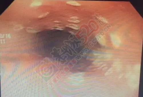 千万别过量服用这些，堪比“吸毒”！730 / 作者:人艰不拆 / 帖子ID:129141