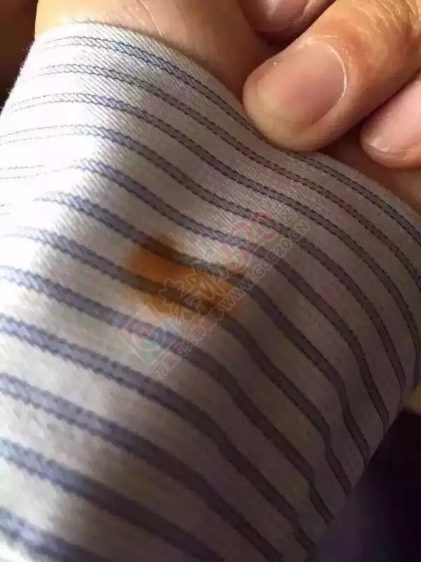 把酱油弄到了衣服上还好我有神器913 / 作者:Trainle_h66EG / 帖子ID:129210