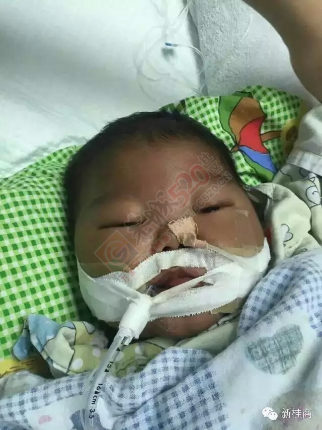 【后续报道】广西人在上海爱心接力，为恭城潮水岩患儿段佳恒集资捐款活动圆满结束！738 / 作者:520小编 / 帖子ID:159200