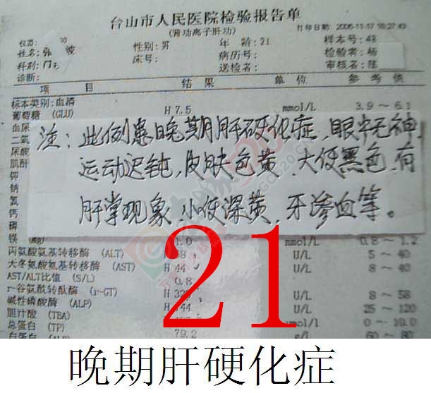 贡献百草奇药截解肝硬化82 / 作者:时珍后人 / 帖子ID:160511