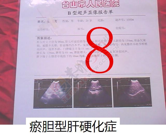 贡献百草奇药截解肝硬化661 / 作者:时珍后人 / 帖子ID:160511