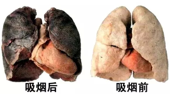 我叫小香，我在恭城祸害了很多男人，我要向他们道歉528 / 作者:微观恭城 / 帖子ID:161149