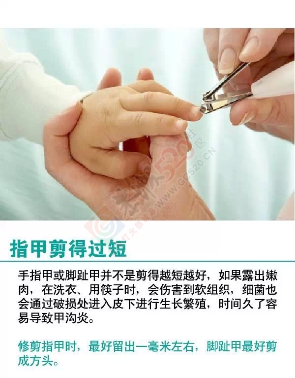 挖耳屎、剪指甲...99%的人不知道这对身体最有害！！928 / 作者:人艰不拆 / 帖子ID:161514