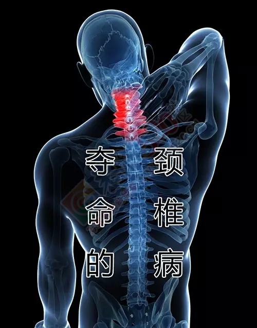 又一位不差钱的走了，死因竟是颈椎病！824 / 作者:人艰不拆 / 帖子ID:162180