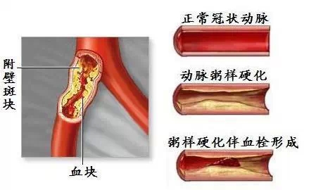 原来海带不能乱吃…现在知道还不晚哦！314 / 作者:人艰不拆 / 帖子ID:162355
