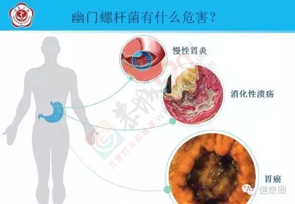 6岁孩子得胃癌！看看他妈平时都给他吃些啥东西！69 / 作者:人艰不拆 / 帖子ID:162407