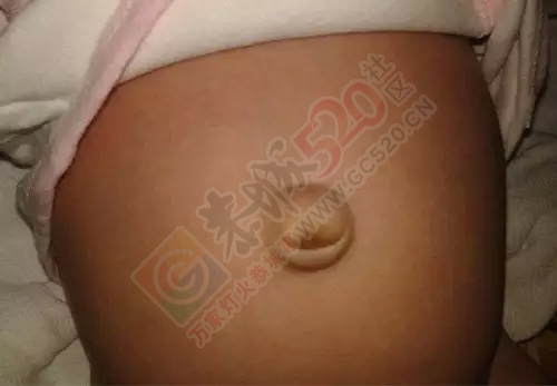 超实用！孩子健不健康，一看肚脐就知晓！367 / 作者:人艰不拆 / 帖子ID:162485