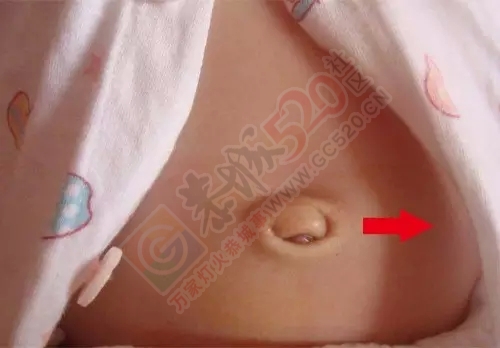 超实用！孩子健不健康，一看肚脐就知晓！882 / 作者:人艰不拆 / 帖子ID:162485
