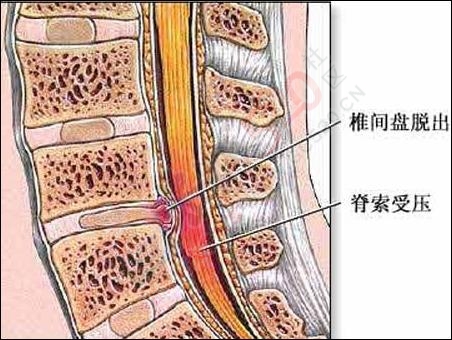 为什么脖子发硬一转就嘎巴响469 / 作者:人艰不拆 / 帖子ID:163035