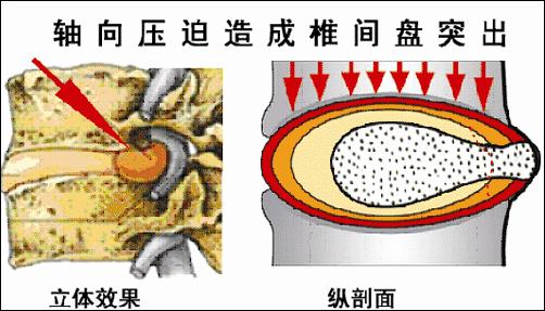为什么脖子发硬一转就嘎巴响31 / 作者:人艰不拆 / 帖子ID:163035