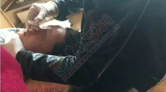 爱美的恭城妹崽当心了！拿鸡腿来练手，3天后客人脸上动刀……434 / 作者:丫丫妹 / 帖子ID:167621