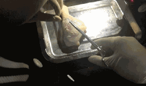爱美的恭城妹崽当心了！拿鸡腿来练手，3天后客人脸上动刀……467 / 作者:丫丫妹 / 帖子ID:167621