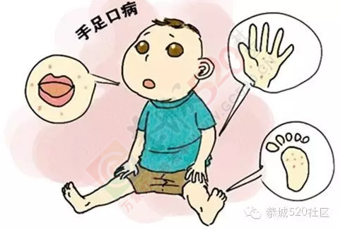恭城家长，积极行动起来，预防手足口病521 / 作者:今日恭城 / 帖子ID:168065