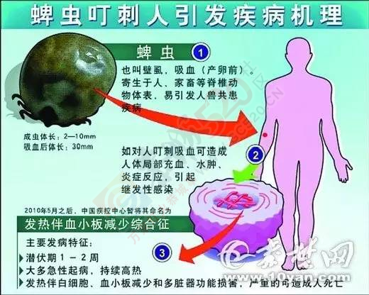 注意！这种恐怖的小虫开始活跃了，被咬一口或可致命！419 / 作者:心交朋友钱交狗 / 帖子ID:168723