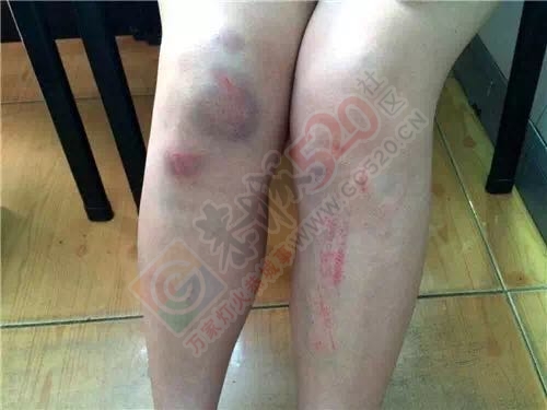 单身女性夜行请注意了！90后美女被扇巴掌、掐脖强拖至地下室……729 / 作者:今日恭城 / 帖子ID:173660