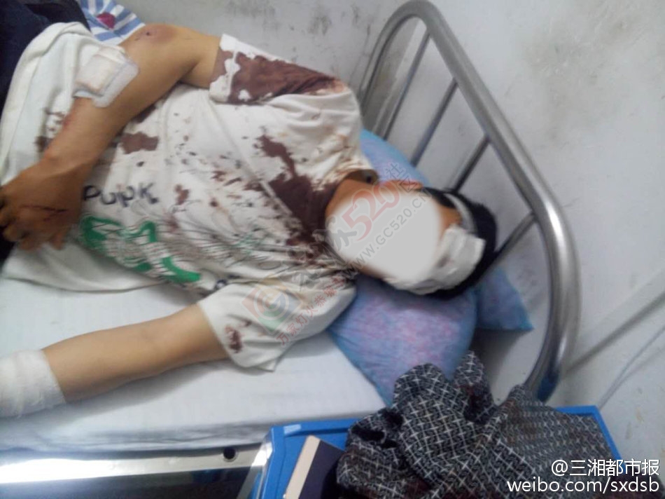 【湖南男子在广西遭暴打 只因向当地小孩问路】838 / 作者:心交朋友钱交狗 / 帖子ID:173691