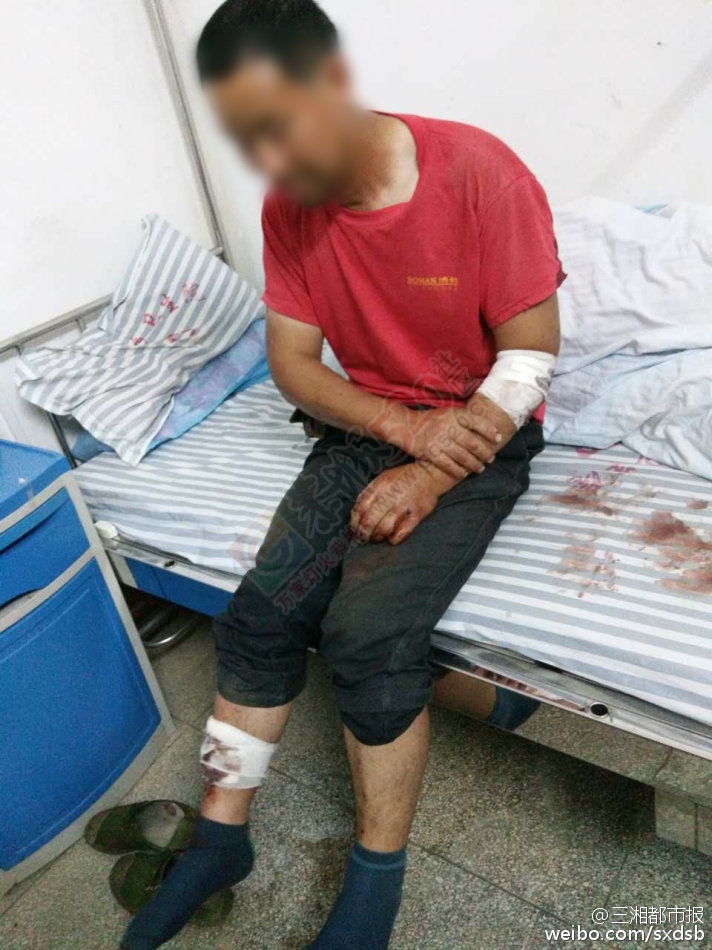 【湖南男子在广西遭暴打 只因向当地小孩问路】893 / 作者:心交朋友钱交狗 / 帖子ID:173691
