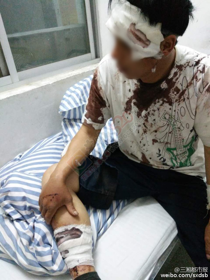 【湖南男子在广西遭暴打 只因向当地小孩问路】89 / 作者:心交朋友钱交狗 / 帖子ID:173691