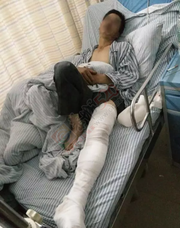 三人在恭城问路被当人贩子 遭20余人暴打重伤！195 / 作者:鸦雀无声 / 帖子ID:173764