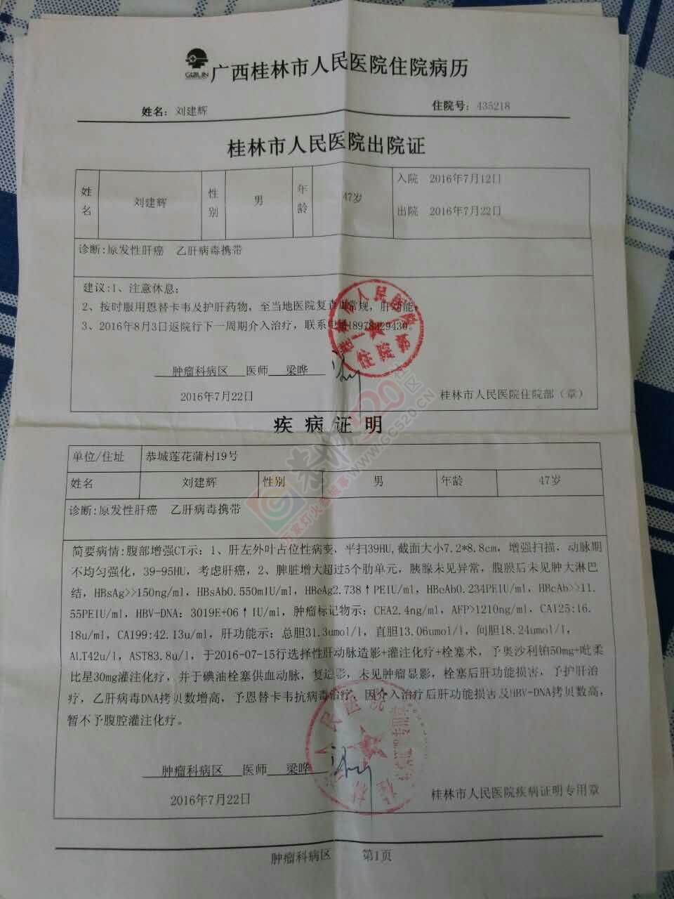 47岁原发性肝癌，希望社会上的好心人帮帮忙660 / 作者:容聪 / 帖子ID:176721