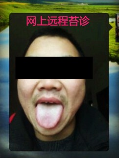 圆 您 中 医 大 夫 梦819 / 作者:时珍后人 / 帖子ID:206779