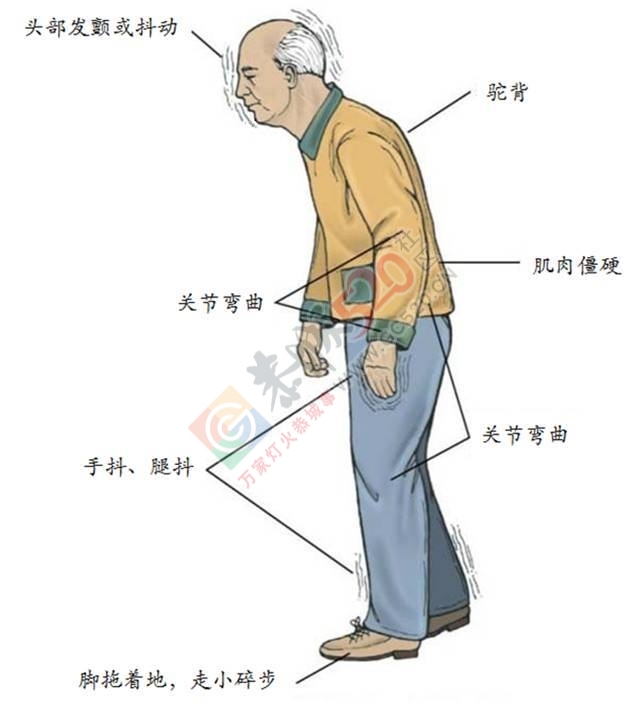 这种病在桂林的发病率持续上升！你如果符合这些状况，那就危险了！83 / 作者:一路坚持 / 帖子ID:207107