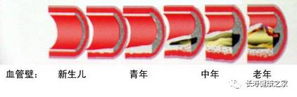 唯此一种豆，给血管减龄！百种做法里，这5种最好~不是黄豆750 / 作者:健康小天使 / 帖子ID:207762