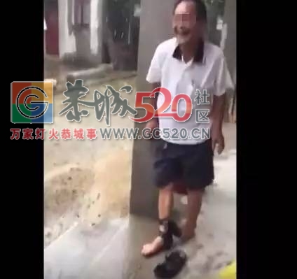 恭城人注意！下雨天千万别穿拖鞋！这个网友的经历让人心疼……383 / 作者:A梦angel / 帖子ID:232253