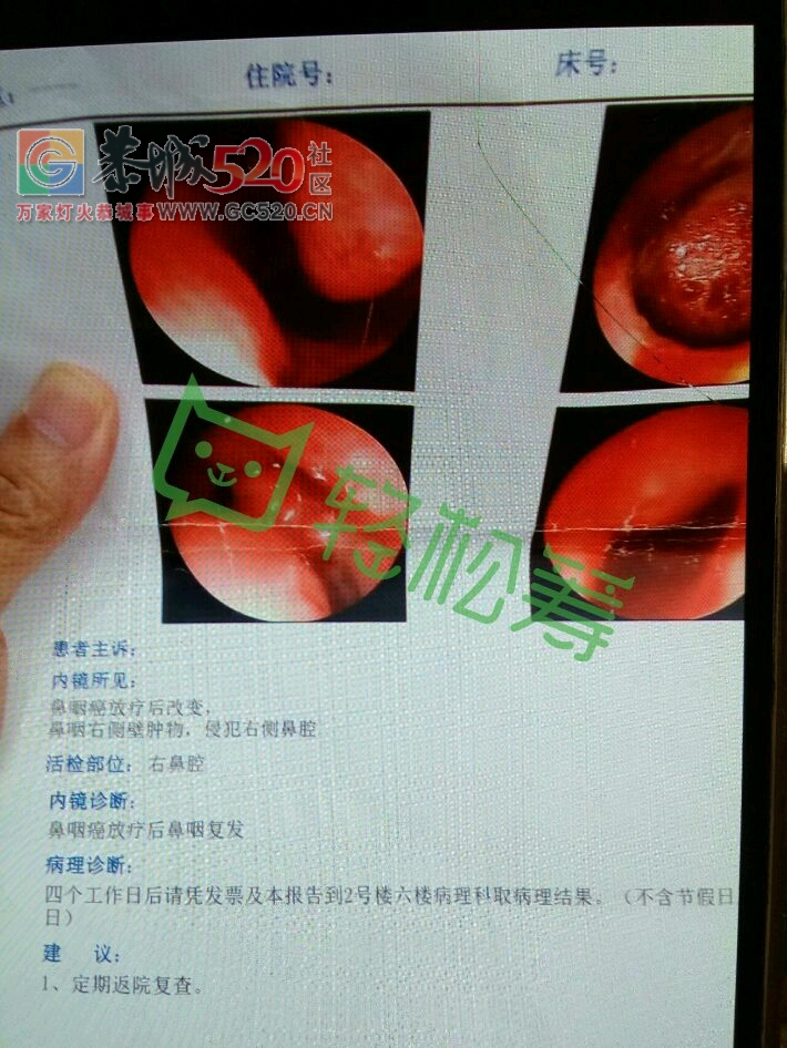 是我亲大哥，万能的朋友圈帮帮他吧！好人一生平安！[玫瑰]牵挂你的人
剩余25天
请各位爱心人士，救救我丈夫，家里的顶梁柱327 / 作者:cjx陈 / 帖子ID:234043