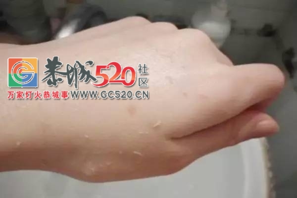 总以为洗澡时搓下的泥很脏 其实还有保护皮肤的作用337 / 作者:疾控客服 / 帖子ID:235576