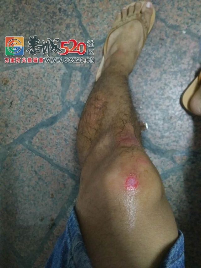 【恭城身边事】 街边办事后路标未撤过路行人被绊倒| 修路本是好事却灰尘满天飞863 / 作者:社区小编 / 帖子ID:236045