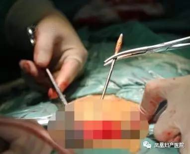 女子疯狂举动拿马铃薯来避孕 ！到医院检查时，结果让医师哭笑不得......425 / 作者:在广州的恭城人 / 帖子ID:236099