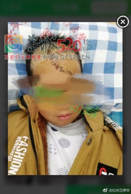 恭城人，快救救这一家人！365 / 作者:边吃边拉 / 帖子ID:246210