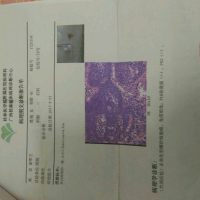 大家帮帮她，四十出头的生命怎这样的不幸。785 / 作者:昨天已不在 / 帖子ID:246762