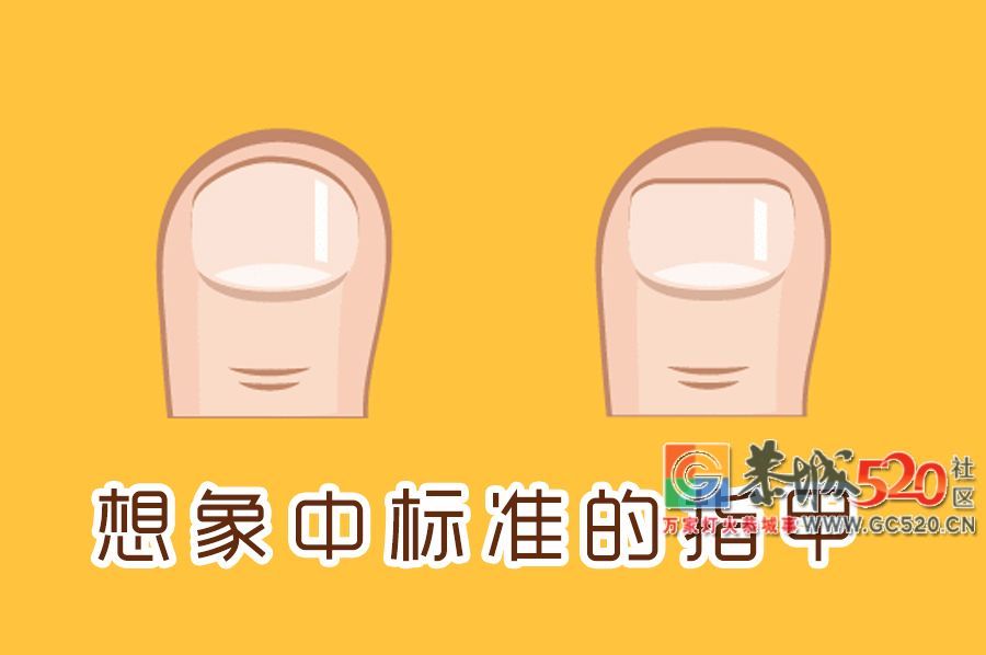 指甲剪不对，带来大麻烦！正确剪指甲应该这样做……45 / 作者:等风十里 / 帖子ID:261984