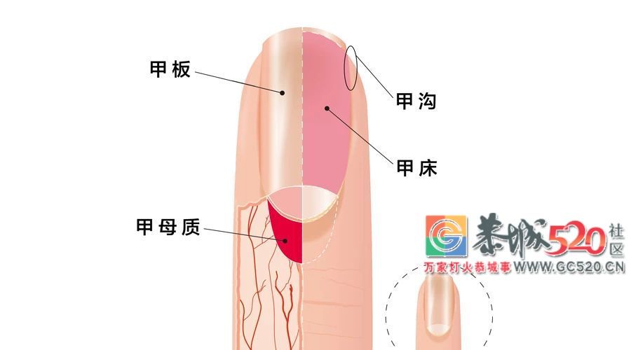 指甲剪不对，带来大麻烦！正确剪指甲应该这样做……118 / 作者:等风十里 / 帖子ID:261984