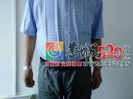 自创偏方！老人吃掉上百支“皮炎平”软膏，医生一问都懵了……447 / 作者:何明明 / 帖子ID:263044