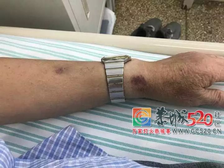 自创偏方！老人吃掉上百支“皮炎平”软膏，医生一问都懵了……357 / 作者:何明明 / 帖子ID:263044