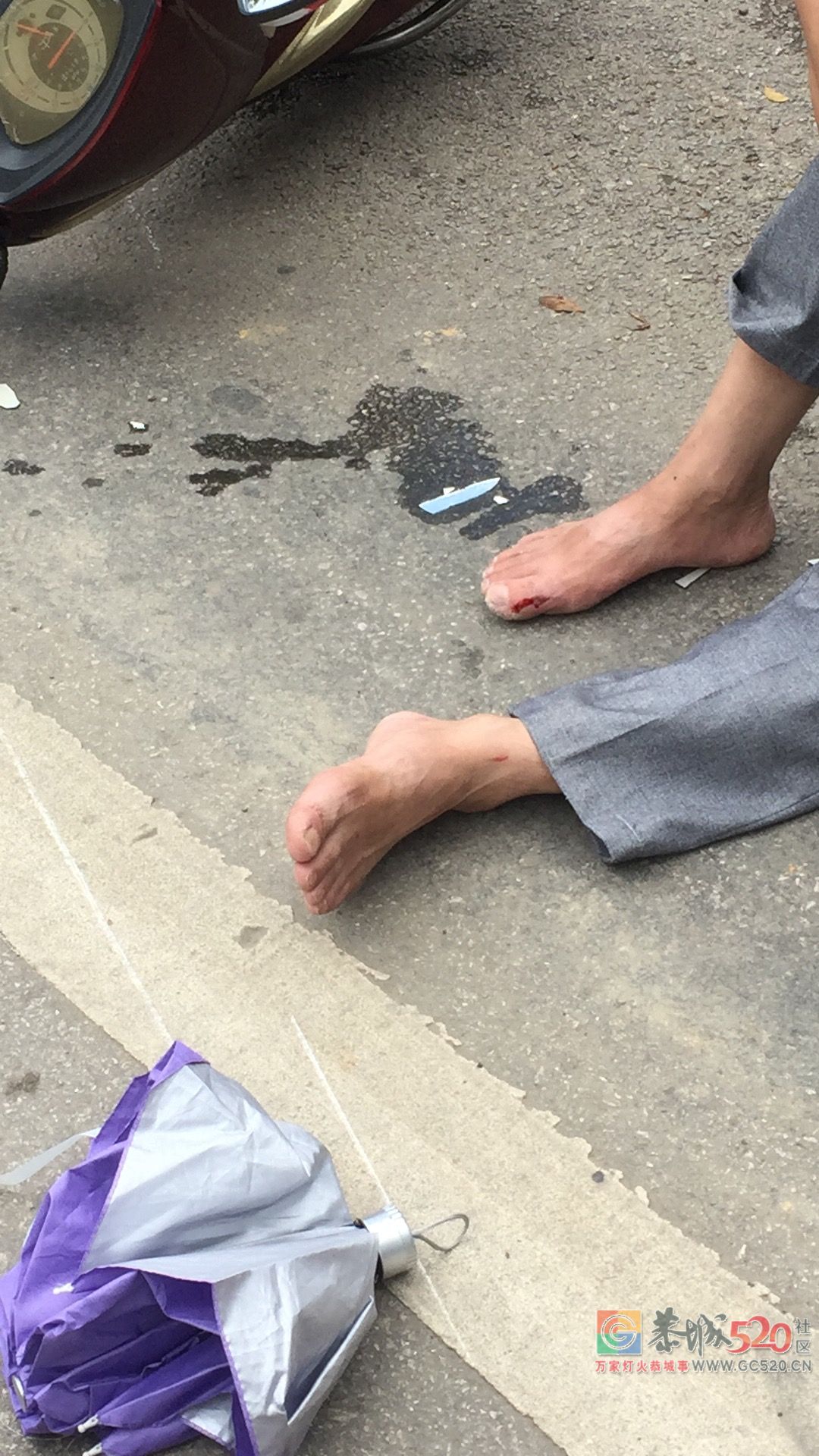 被车子撞了还那么好讲话，第一次见那么好讲话的叔叔！642 / 作者:东门头人 / 帖子ID:263089